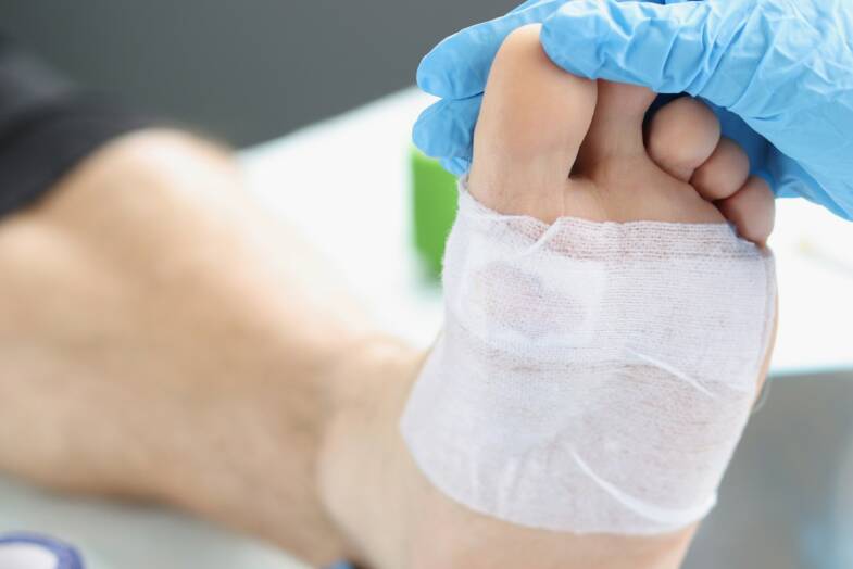Vaskularne komplikacije dijabetesa – dijabetesno stopalo