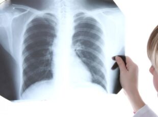 Karcinom pluća odnese 4 500 života godišnje