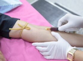 Tradicionalni prijem za doborovljne davaoce krvi